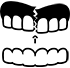 Protesi riparazione